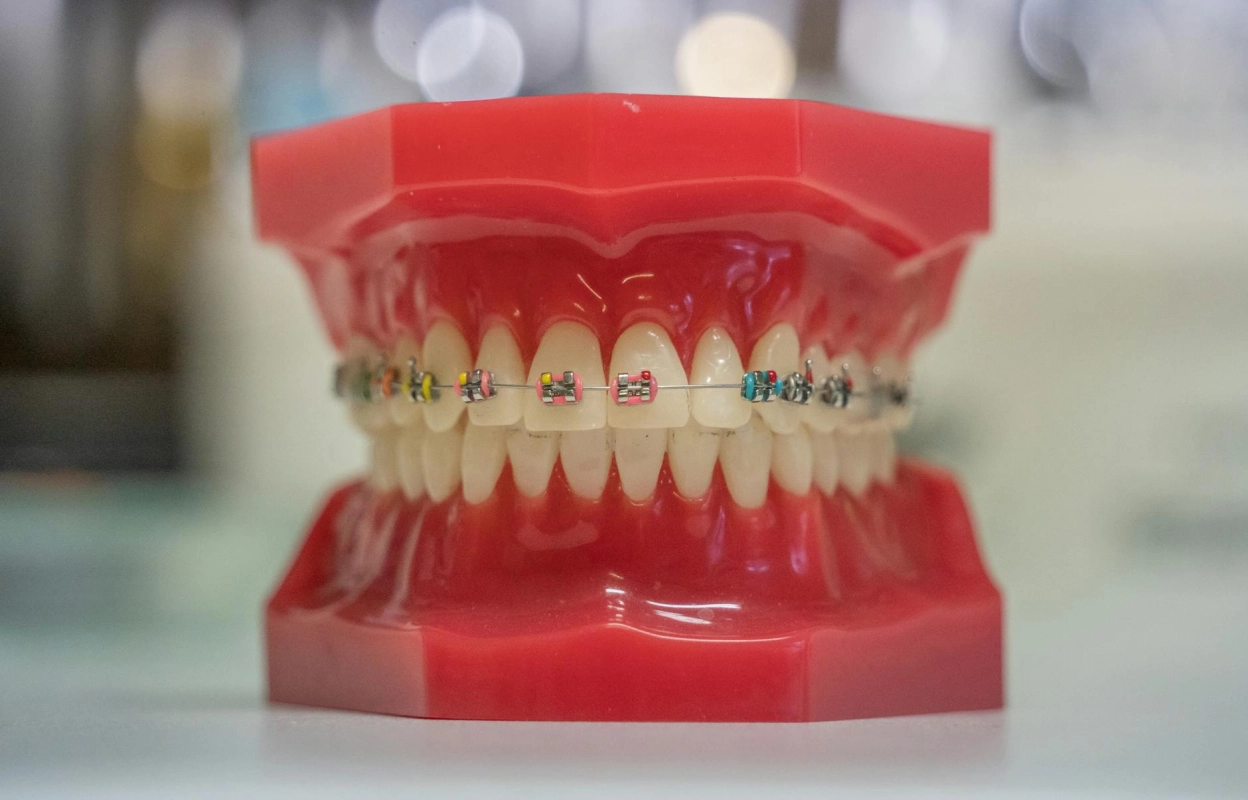 Brackets