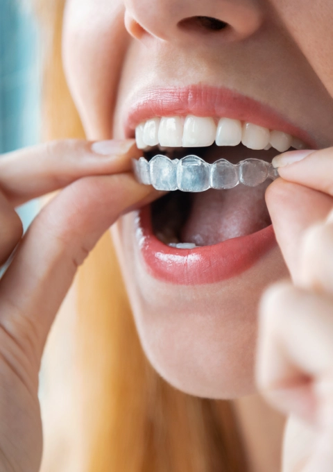 Brushing And Flossing With Braces