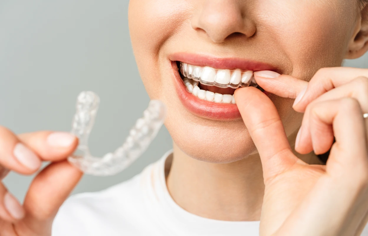 Brushing and Flossing with Braces