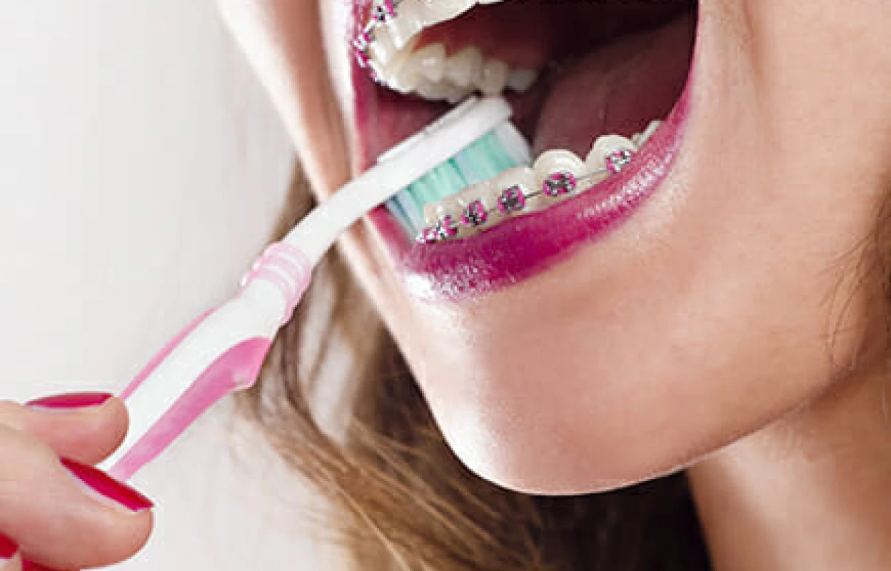 Brushing