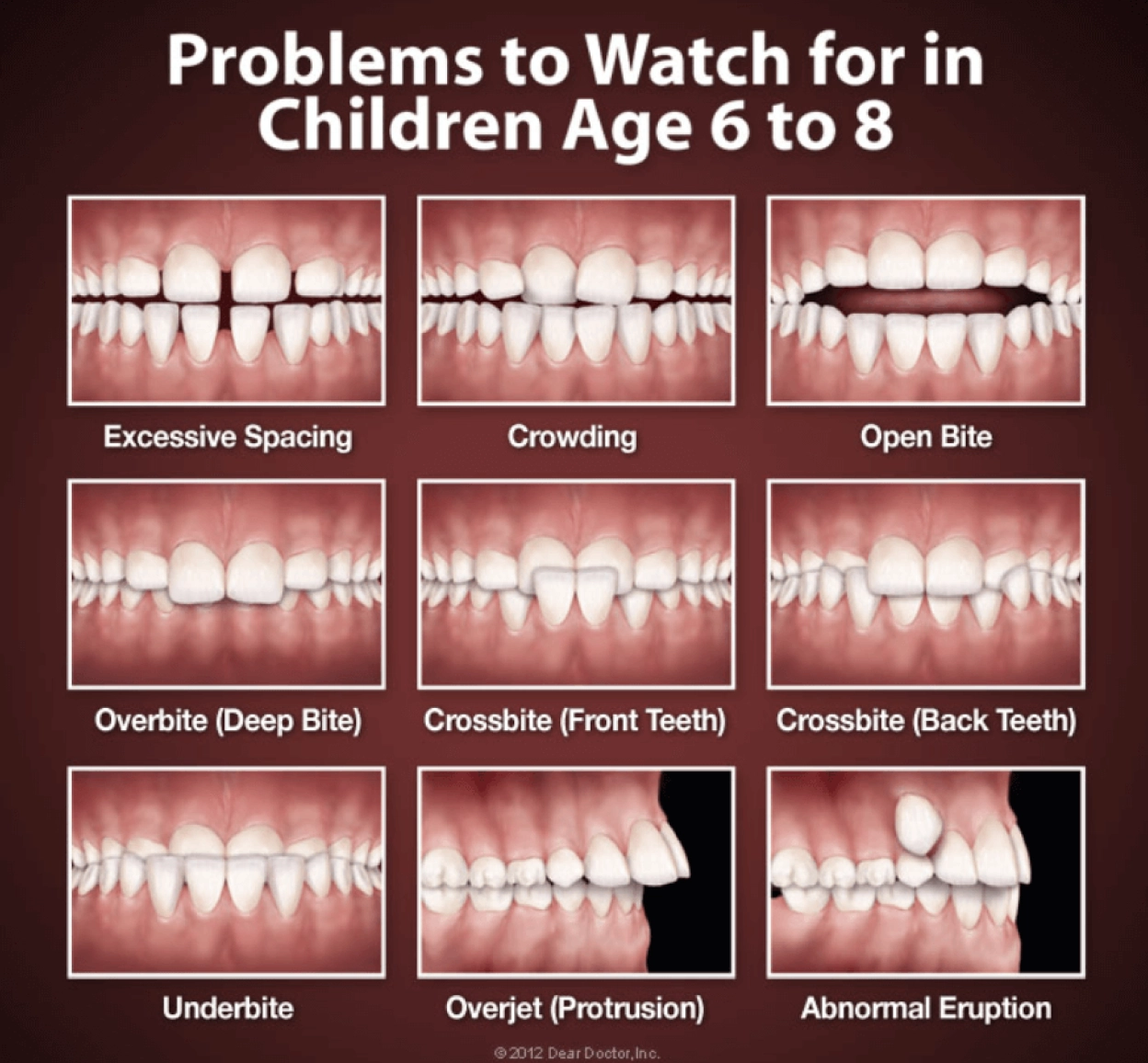 Common Bite Problems & Why They Need Fixing