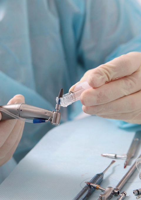 Dental Implants