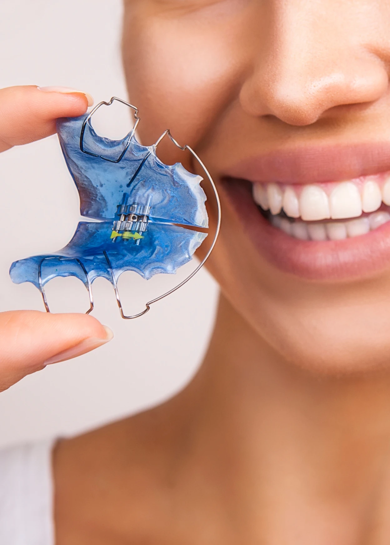 Our Tips for Proper Retainer Usage
