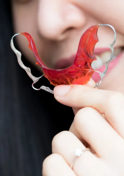 Retainers for Life
