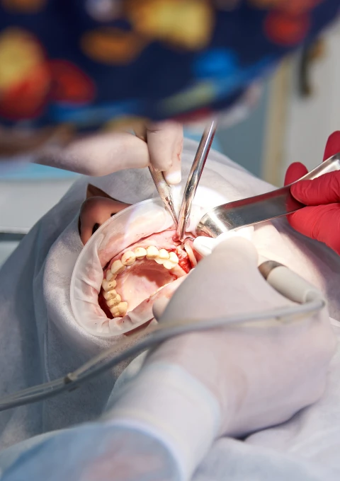 Surgical Orthodontics