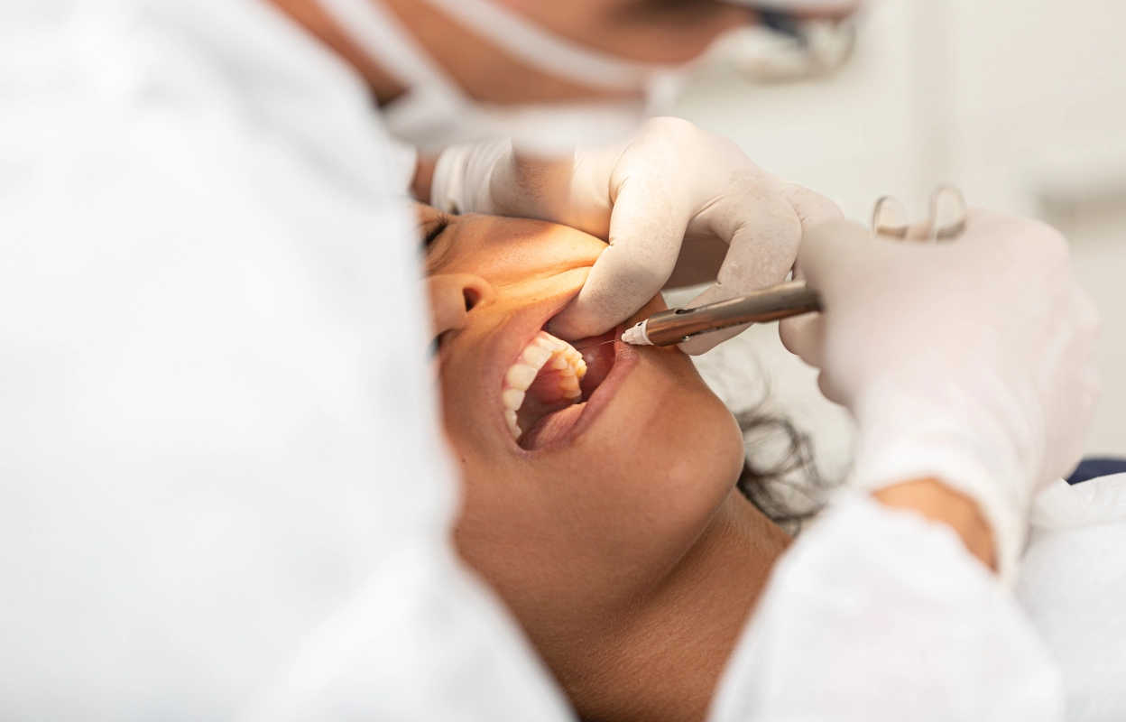 Top 3 Benefits of Removing Wisdom Teeth