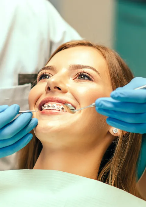Types of Braces