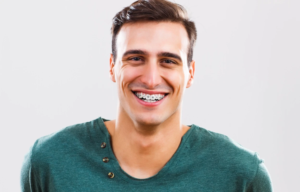 Why You Should Consider Adult Orthodontics