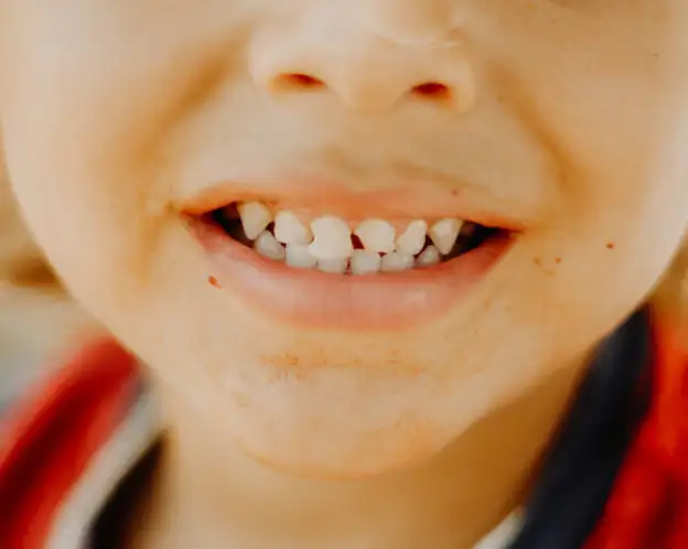 baby-teeth-1x