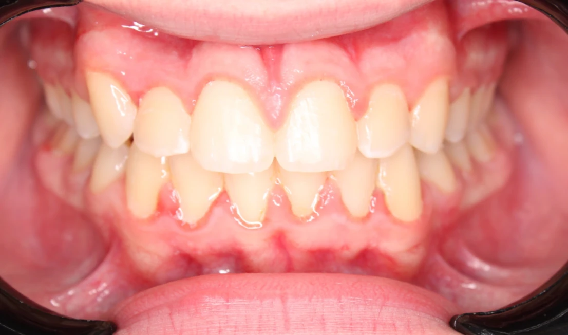 Ortho-After-2