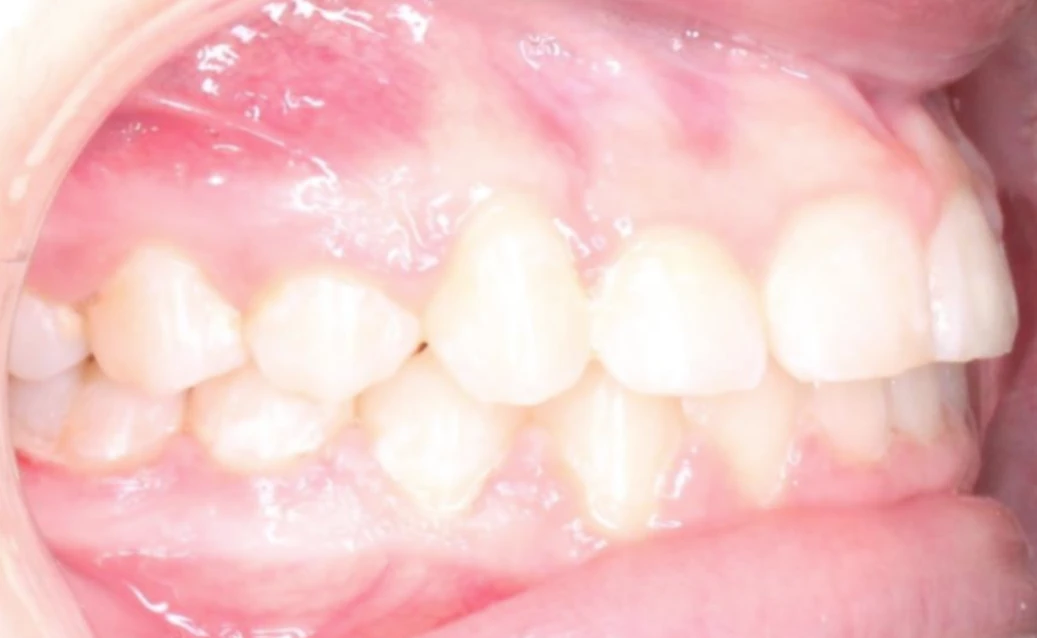 Ortho After 3