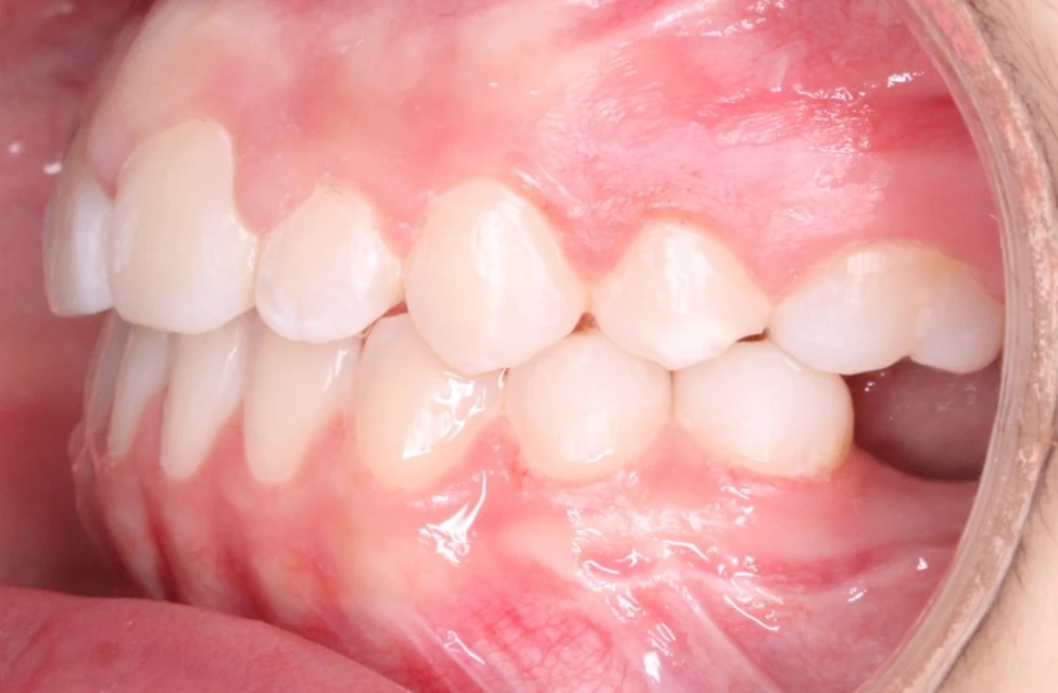 Ortho After 4
