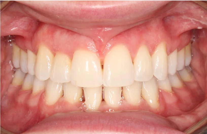 Ortho After 6