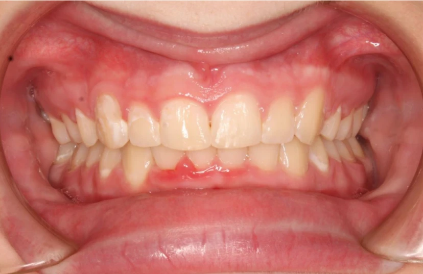 Ortho After 7