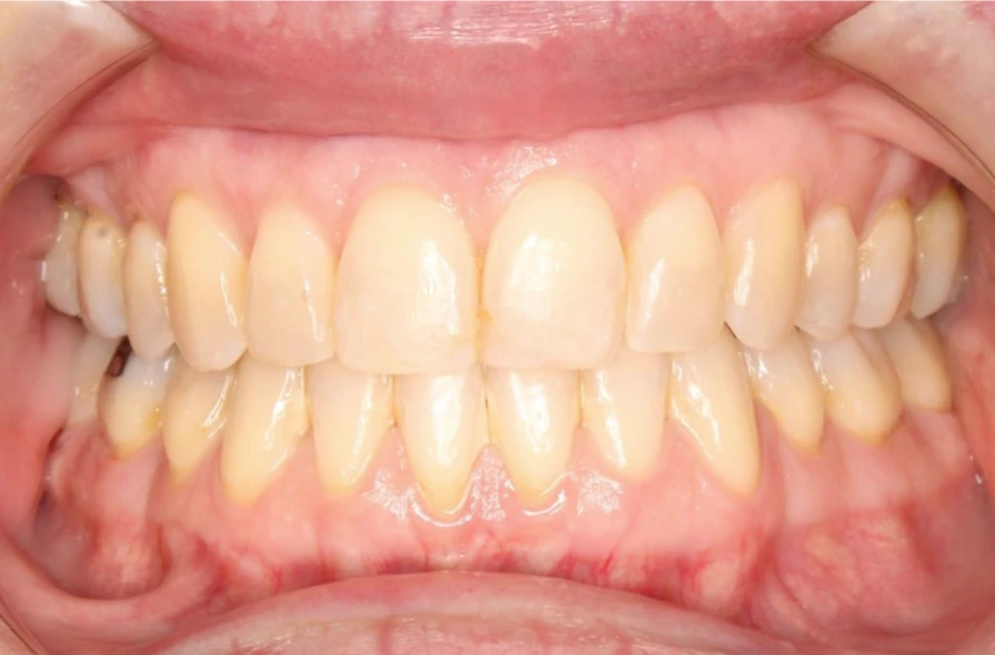 Ortho After 8