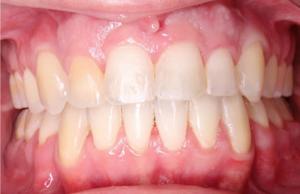 Ortho After 9