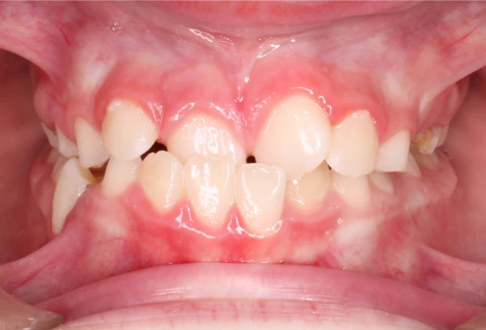 Ortho Before 1