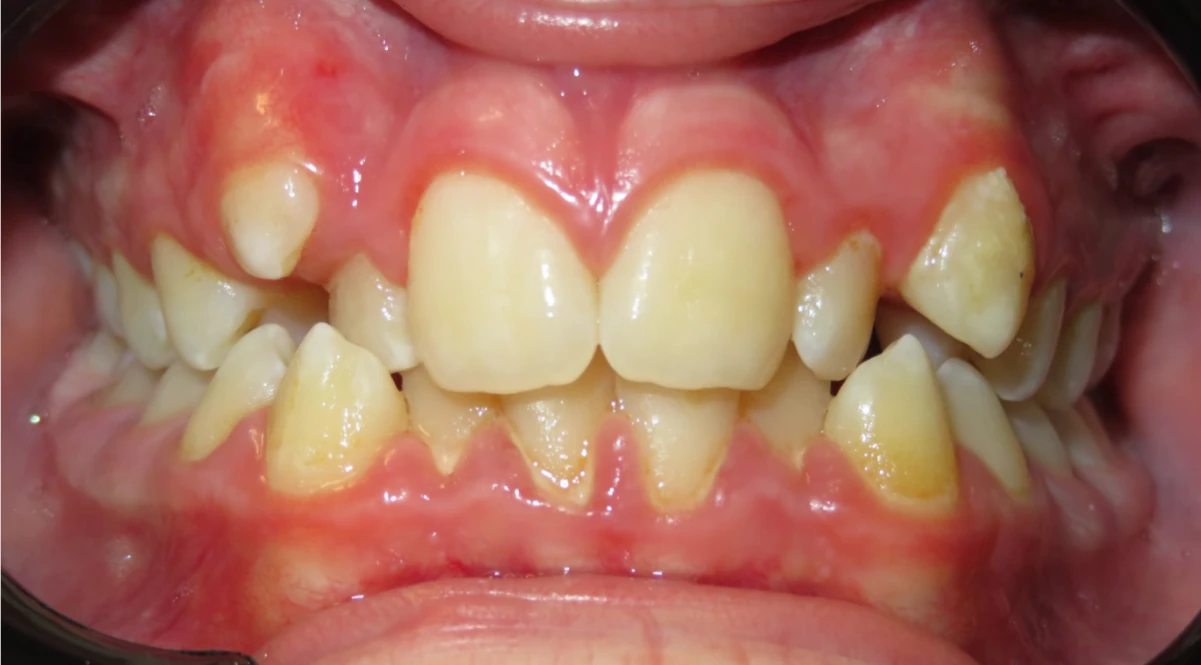 Ortho Before 2