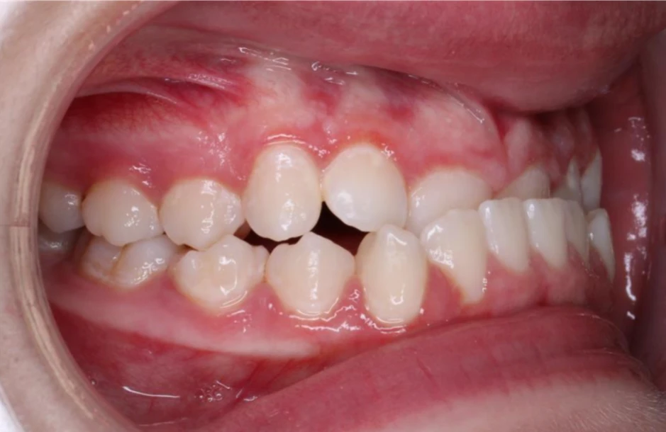 Ortho Before 3