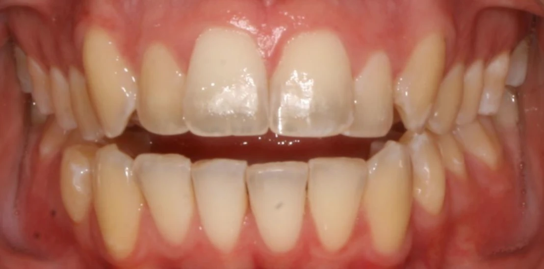 Ortho Before 9