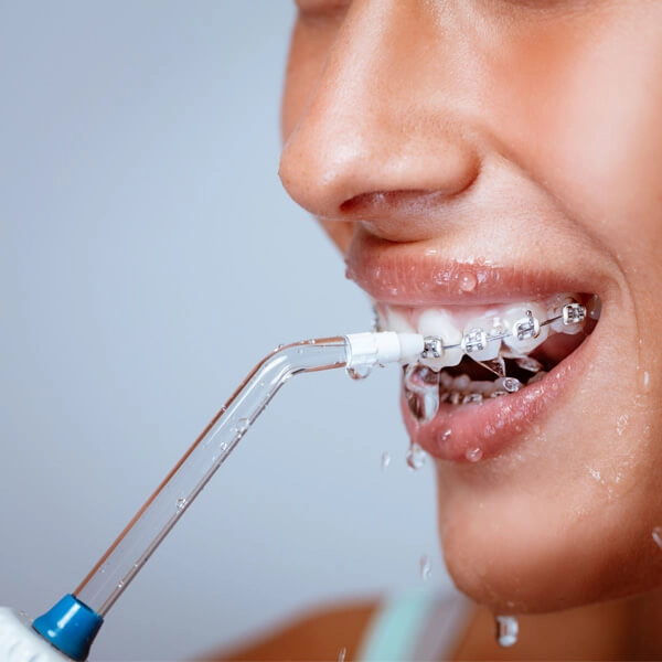 floss-with-braces