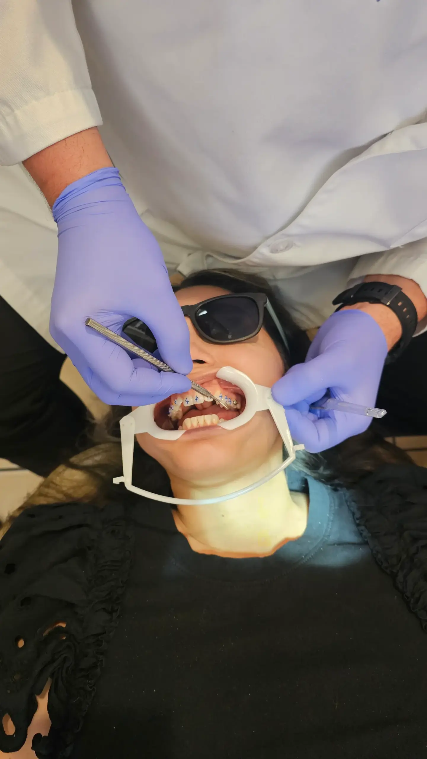 Orthodontic Emergencies
