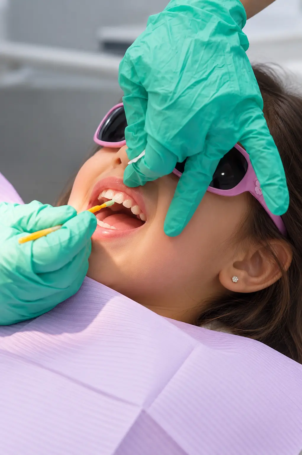 Fluoride Application
